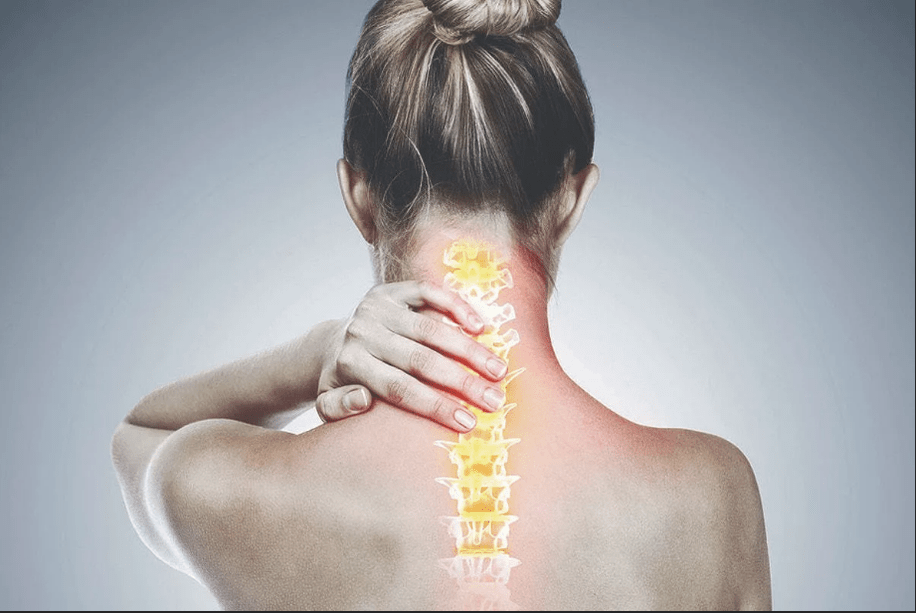 crischondrosis cervical