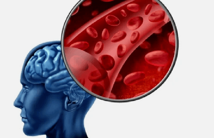Ihe mgbaàmà nke osteochondrosis nke spain cervical