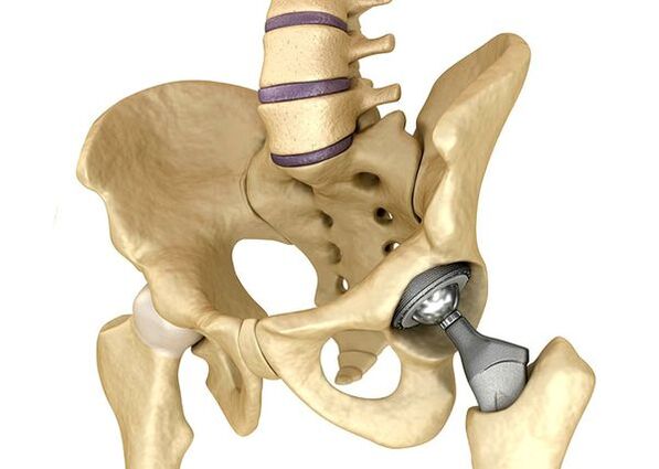 Encposhetics nke nkwonkwo ụkwụ