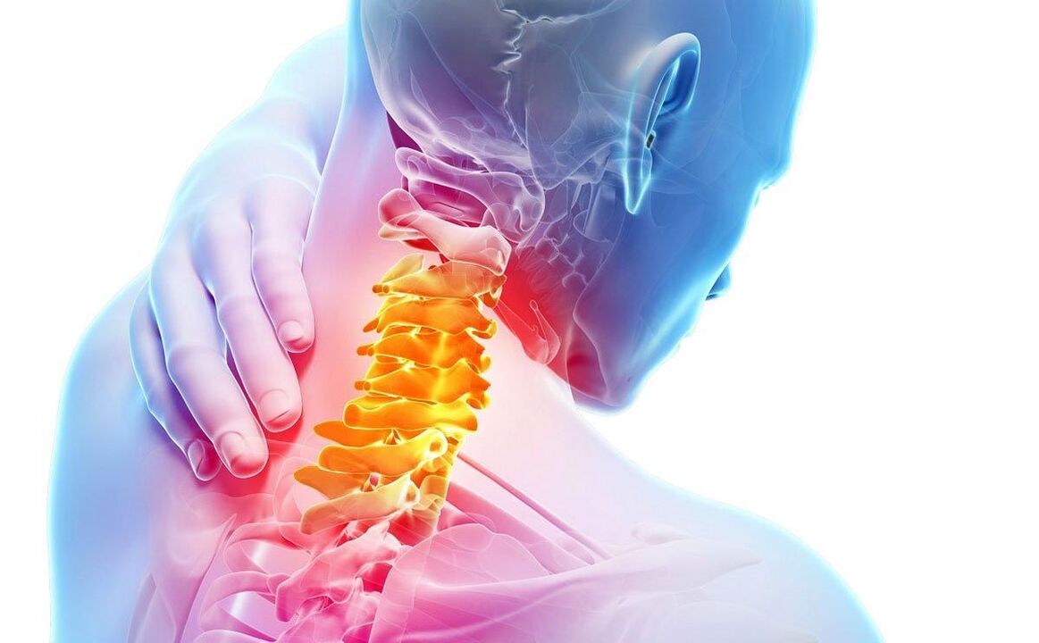 mgbu na osteochondrosis cervical